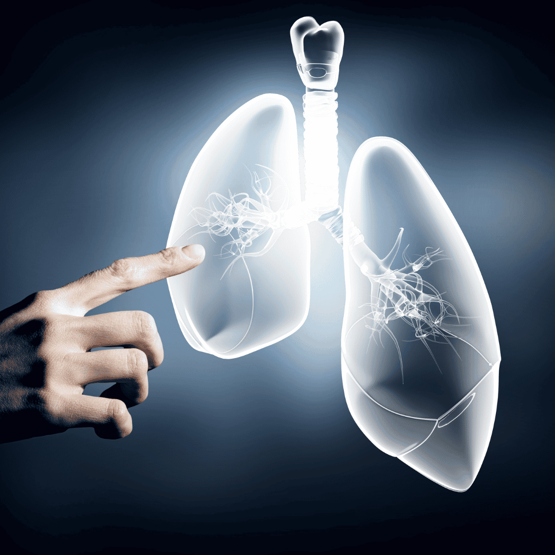 Stem Cell Therapy for COPD in Dubai UAE