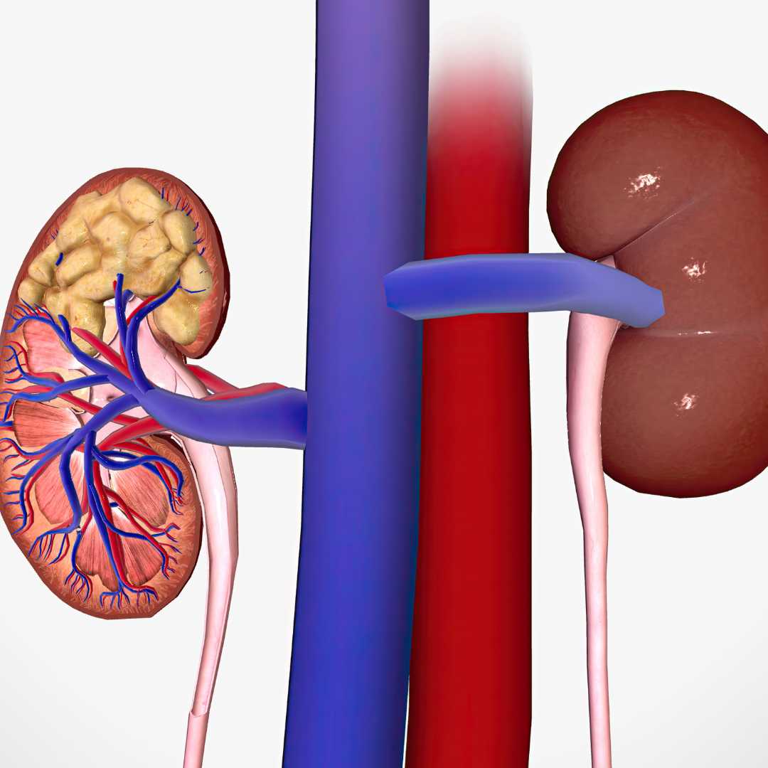 Kidney Transplantation in Istanbul, Turkey