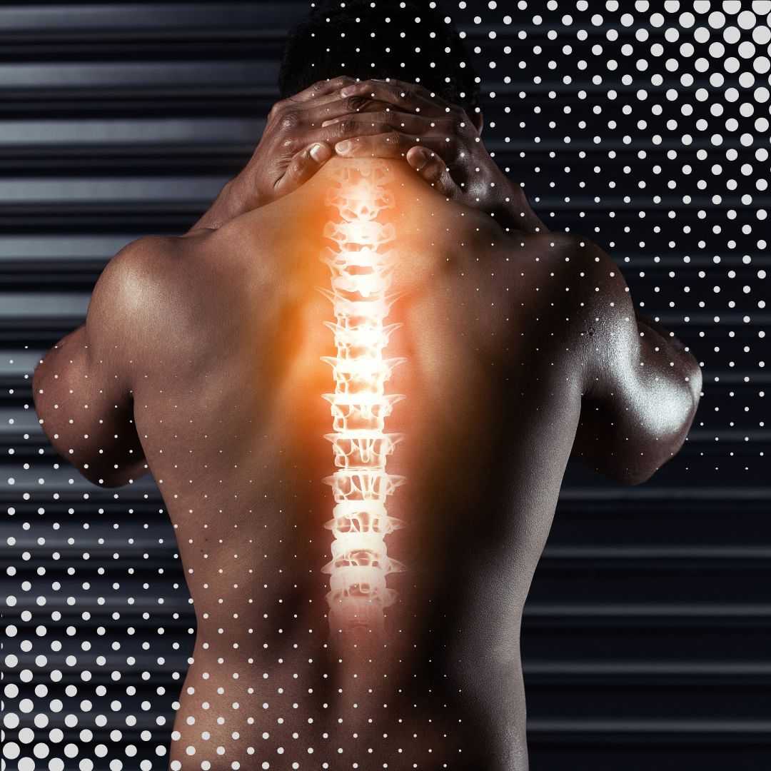 Stem Cell Therapy for Herniated Discs in Dominican Republic