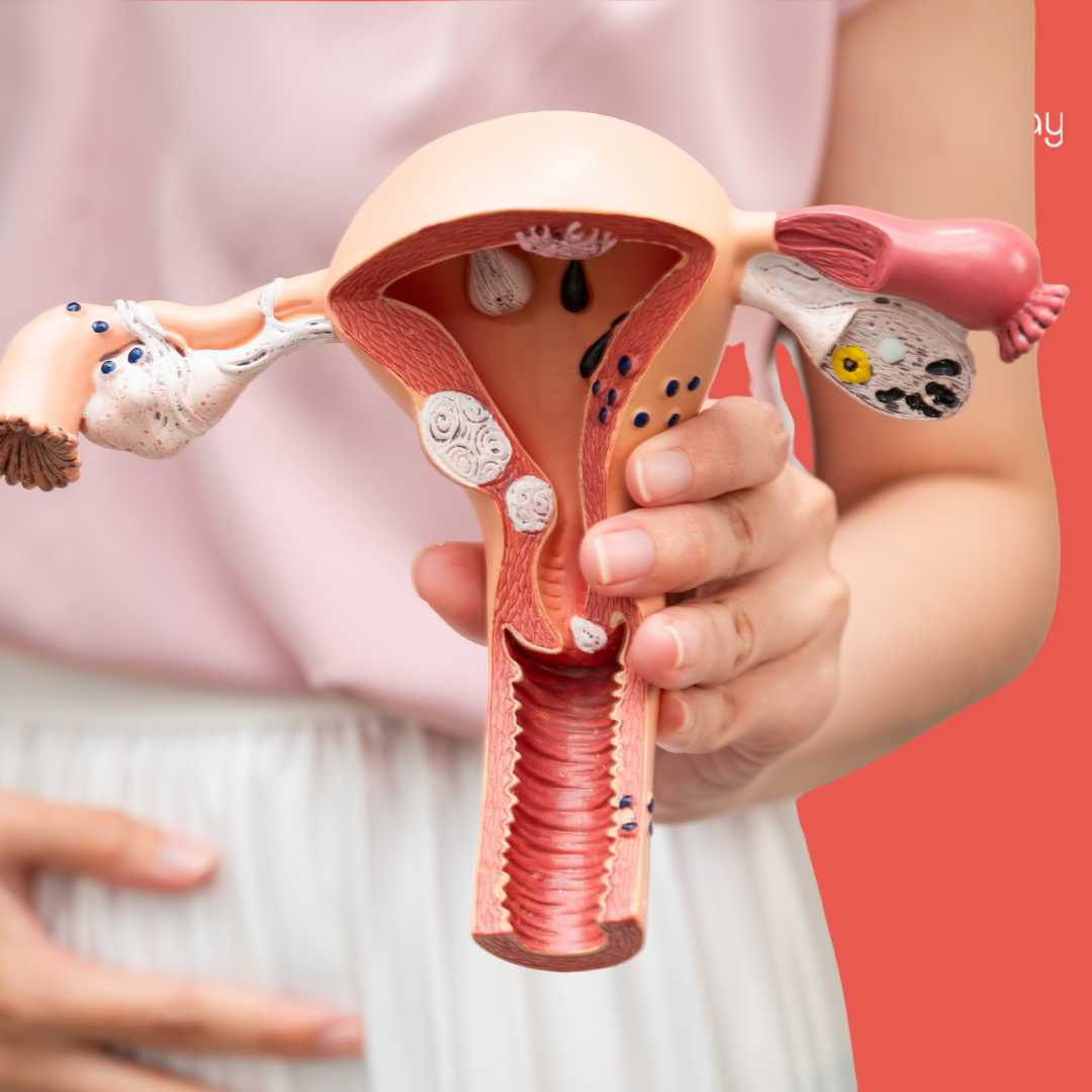 Gynecology Treatment in Turkey