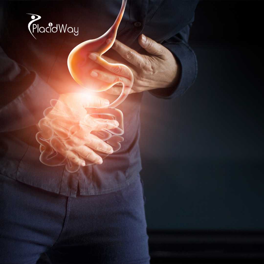 Mini Gastric Bypass in Latin America