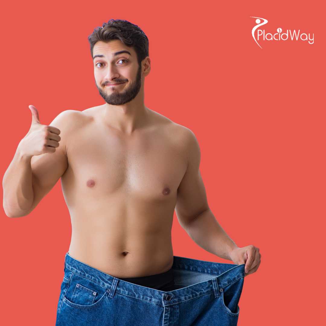 Gastric Sleeve Surgery in Istanbul, Turkey