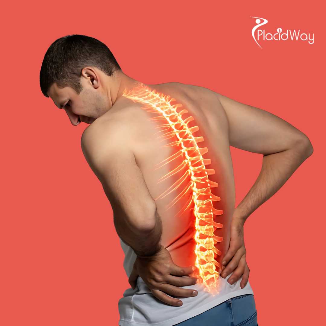 Spine Surgery in India - Get Safe and Effective Care