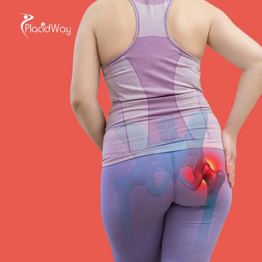 Hip Replacement Surgery in Tijuana, Mexico