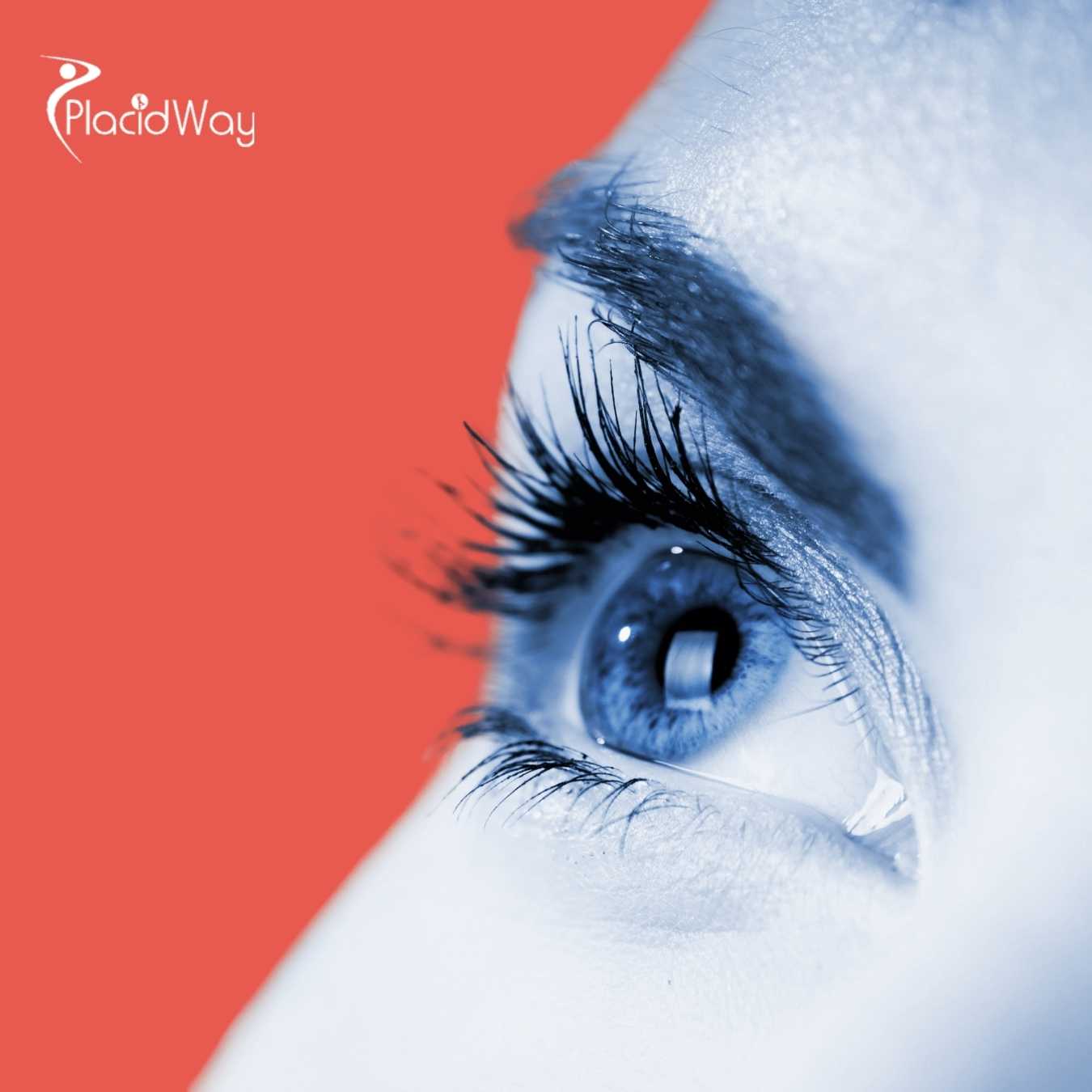 Lasik Surgery in Mexico