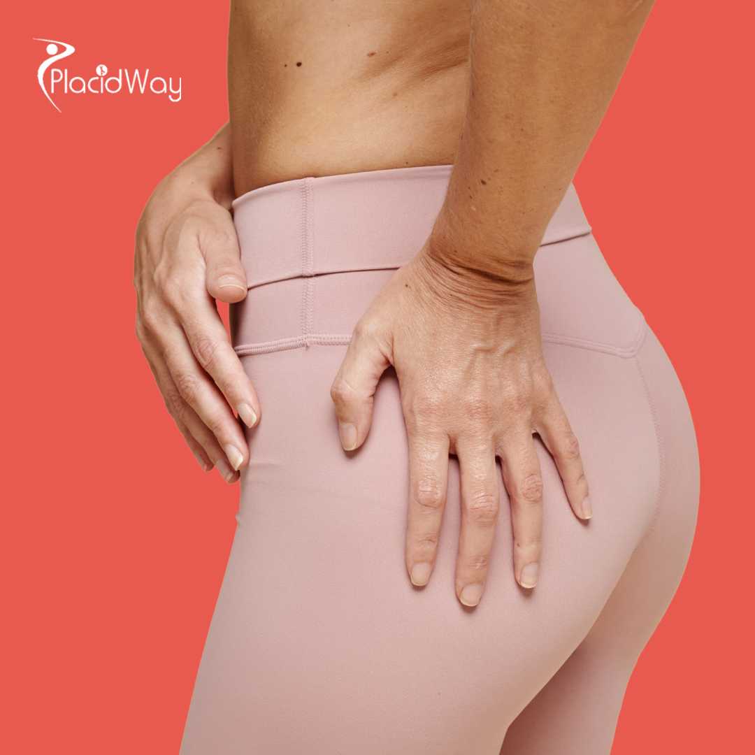 Brazilian Butt Lift in Costa Rica - Choose BBL in Costa Rica