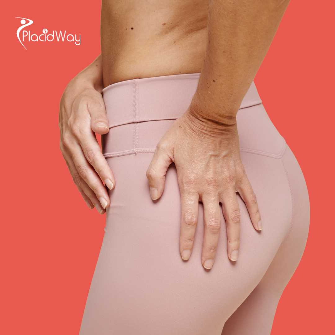 Brazilian Butt Lift in Mexico City, Mexico