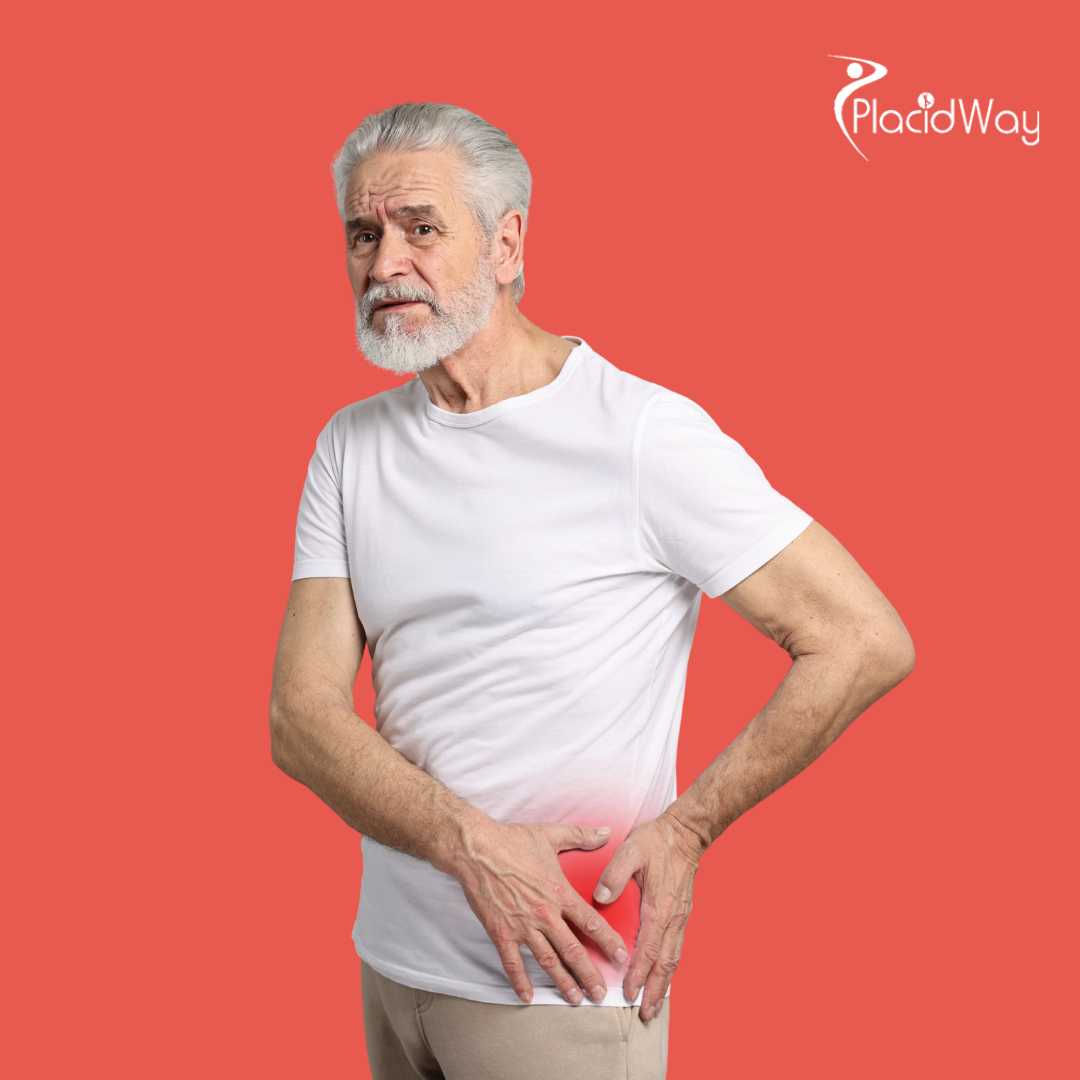 Hip Replacement Surgery in Istanbul, Turkey
