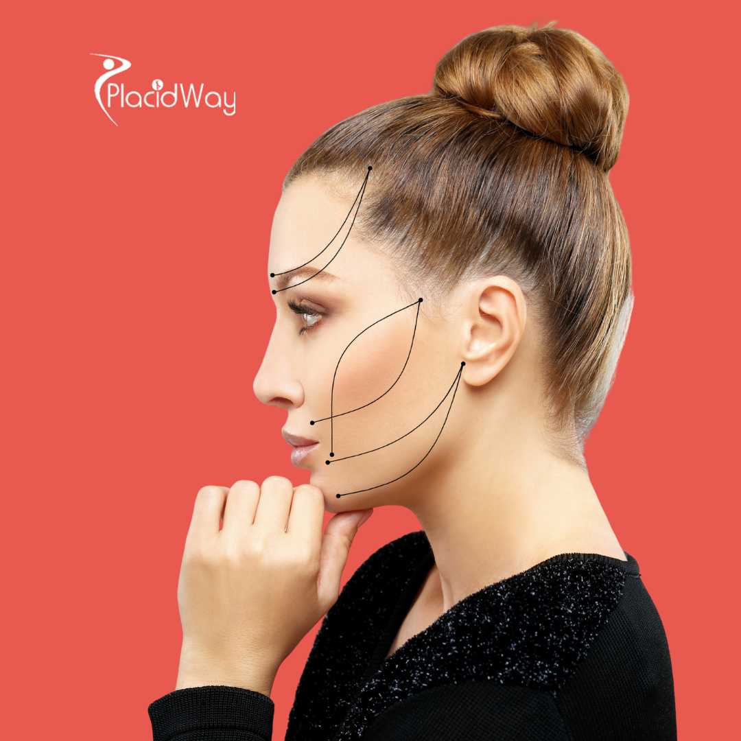 Facelift in Istanbul Turkey