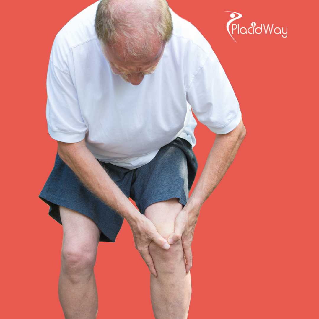 Knee Replacement in Ankara, Turkey