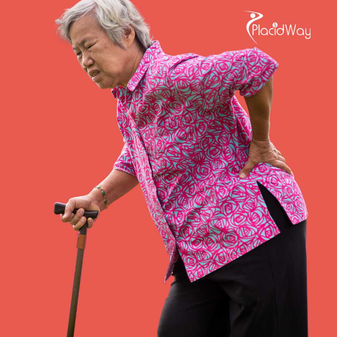 Hip Replacement Surgery in Istanbul, Turkey