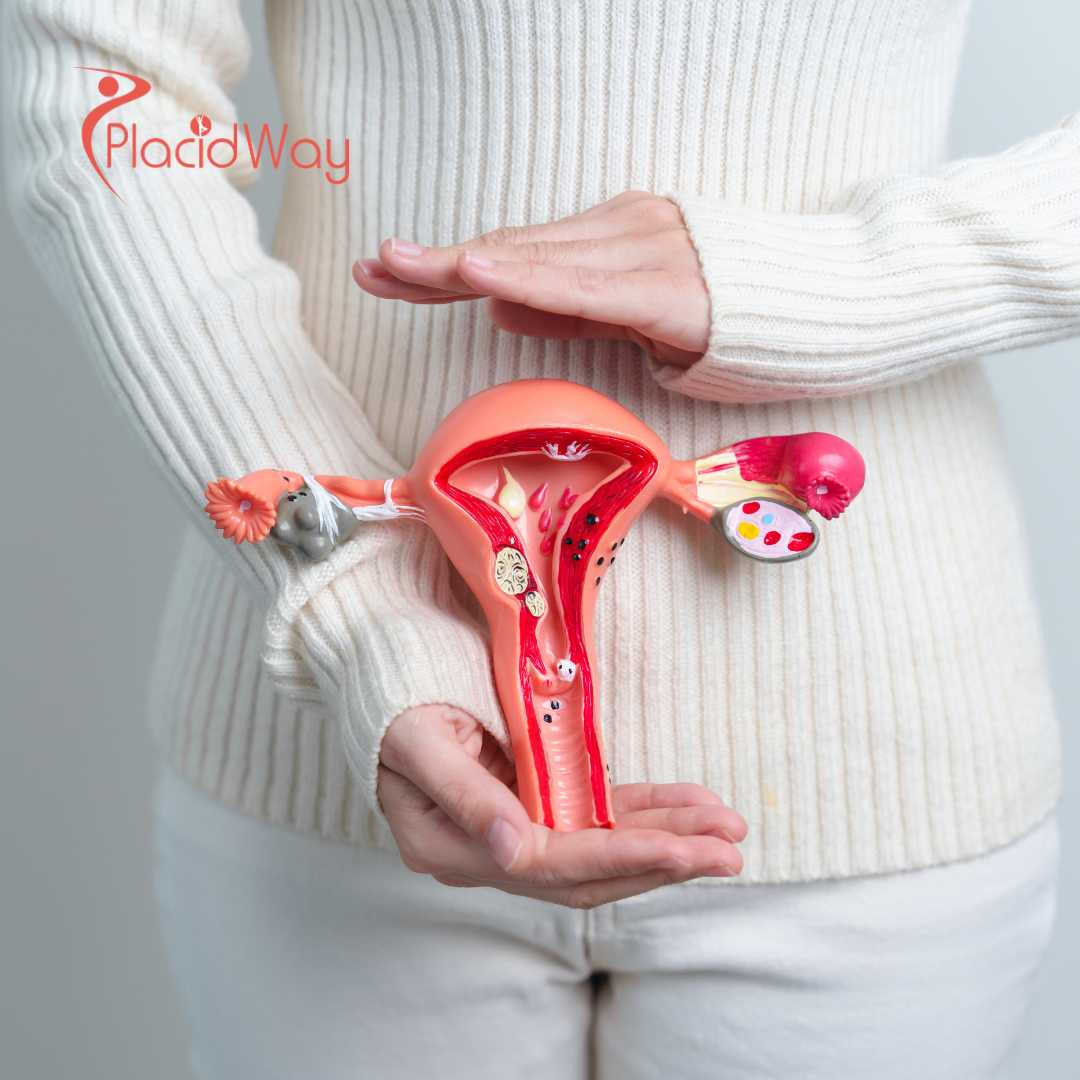 Stem Cell for Ovarian Rejuvenation in Bangkok, Thailand