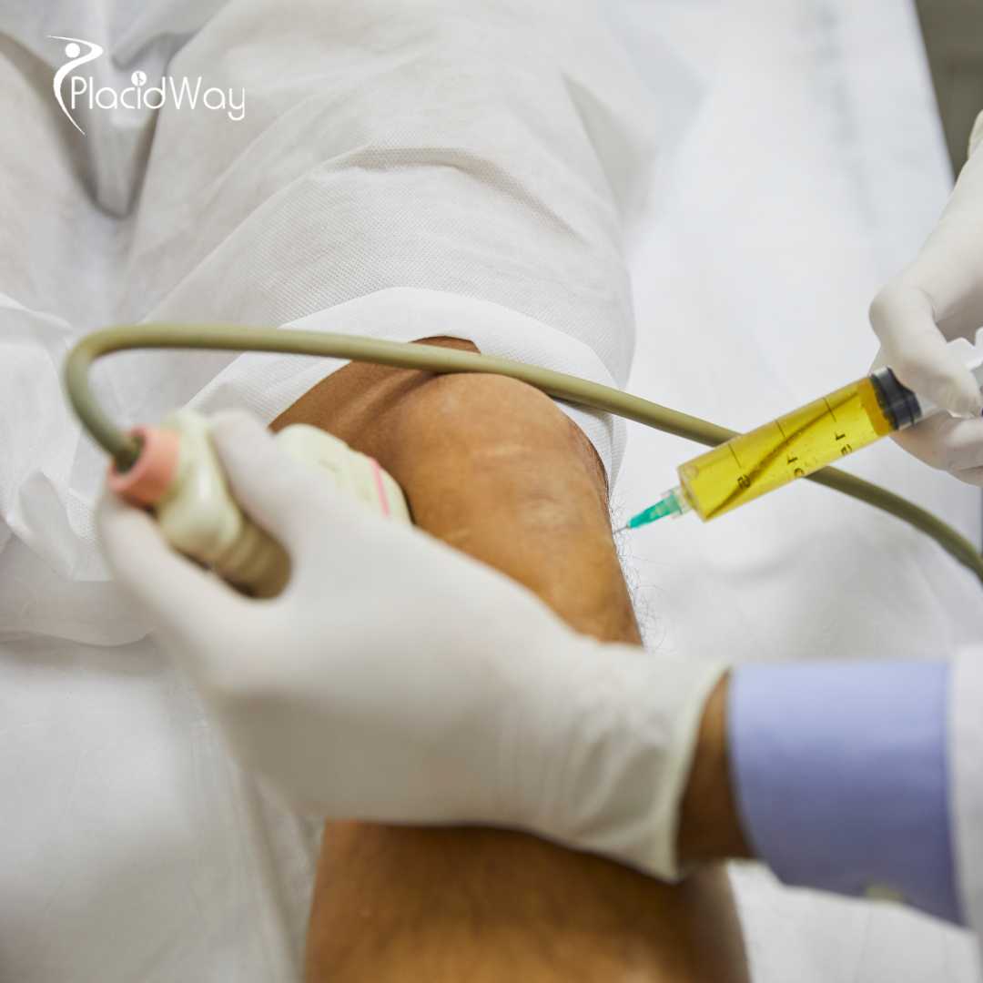 Stem Cell Therapy for Meniscus Tear in Bangkok, Thailand