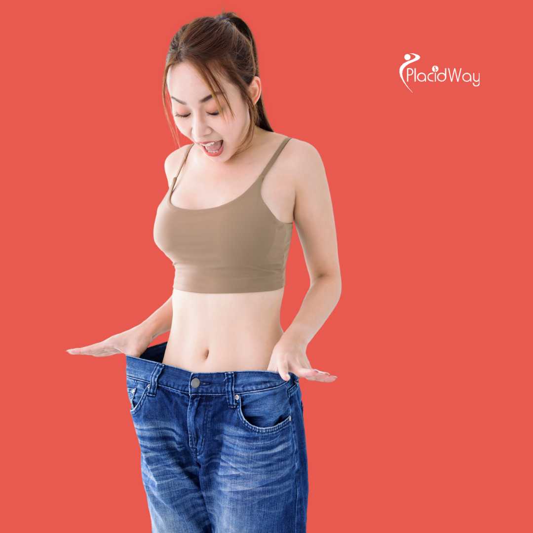 Bariatric Surgery in Merida, Mexico