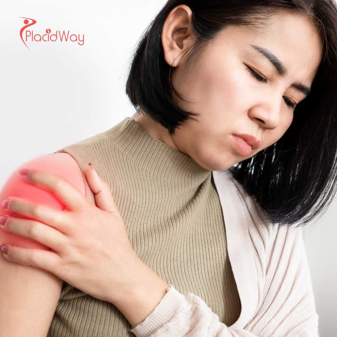 Stem Cell Therapy for Rotator Cuff Tear in Cali, Colombia