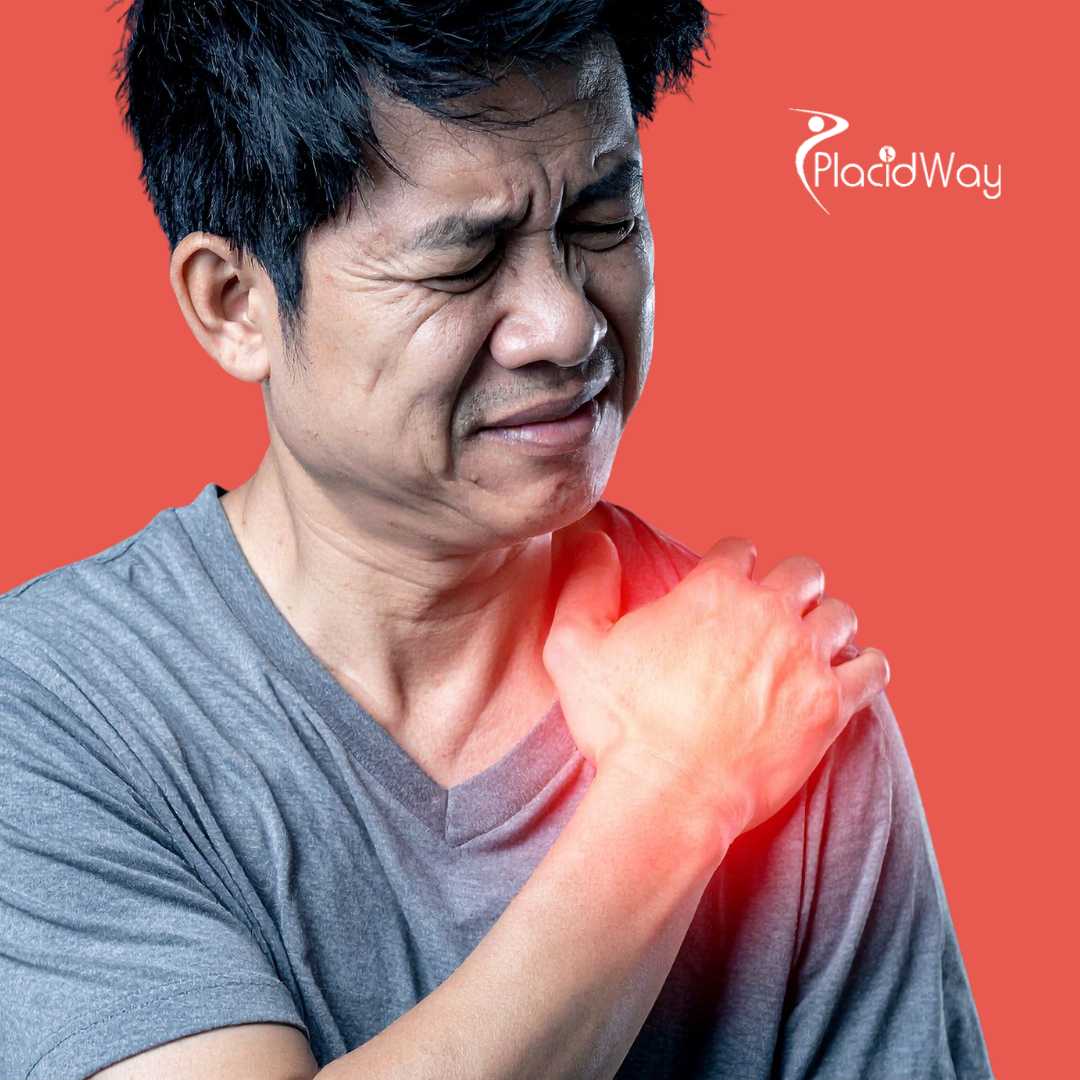 Shoulder Arthroplasty in Bursa, Turkey 