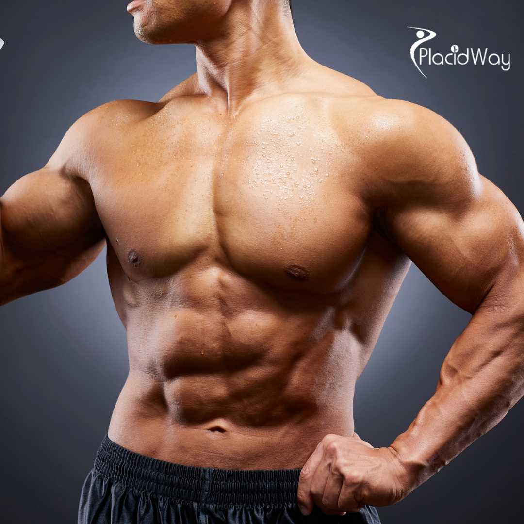 Gynecomastia in Mexico