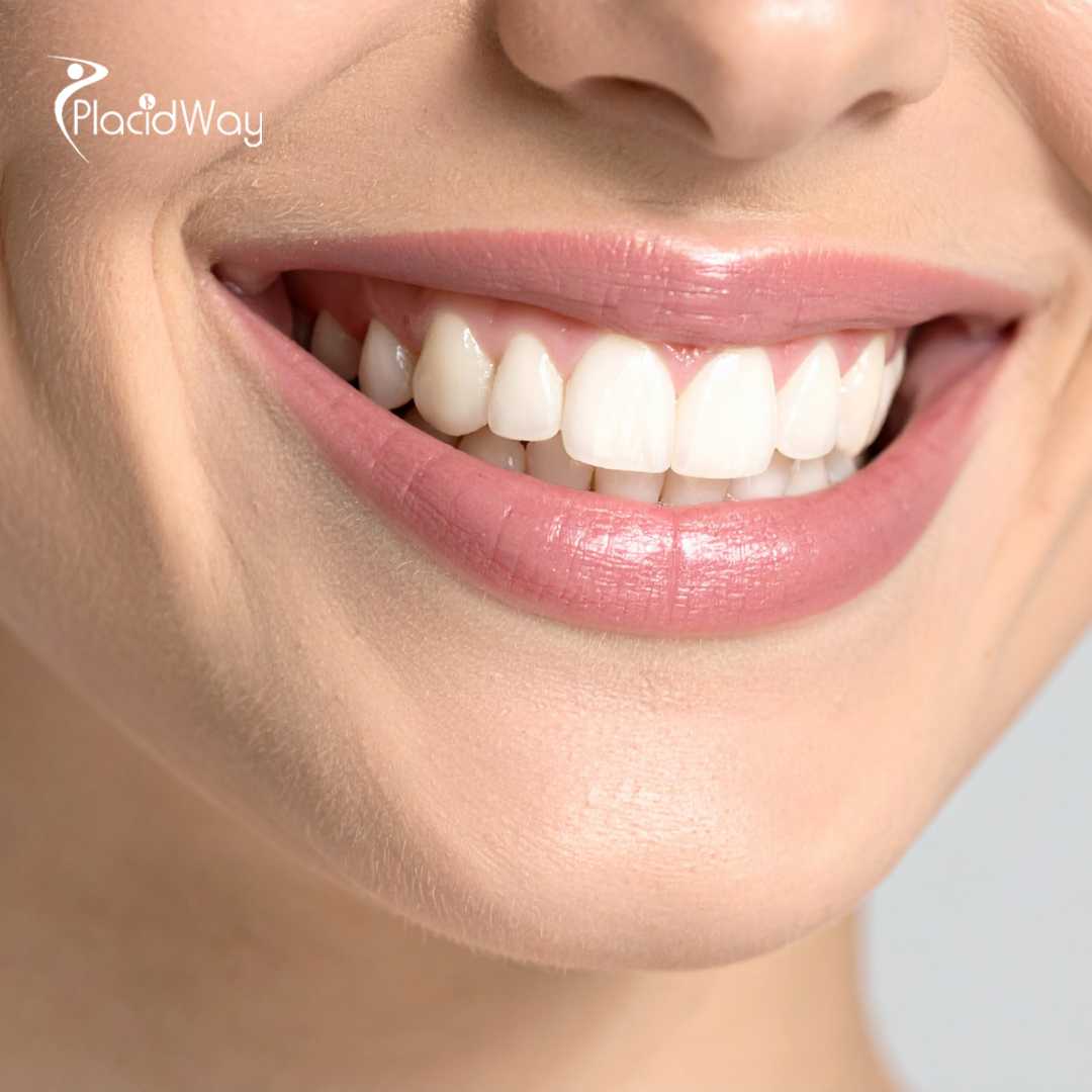 All on 8 Dental Implants in Thailand - Get Dental Implants Abroad 