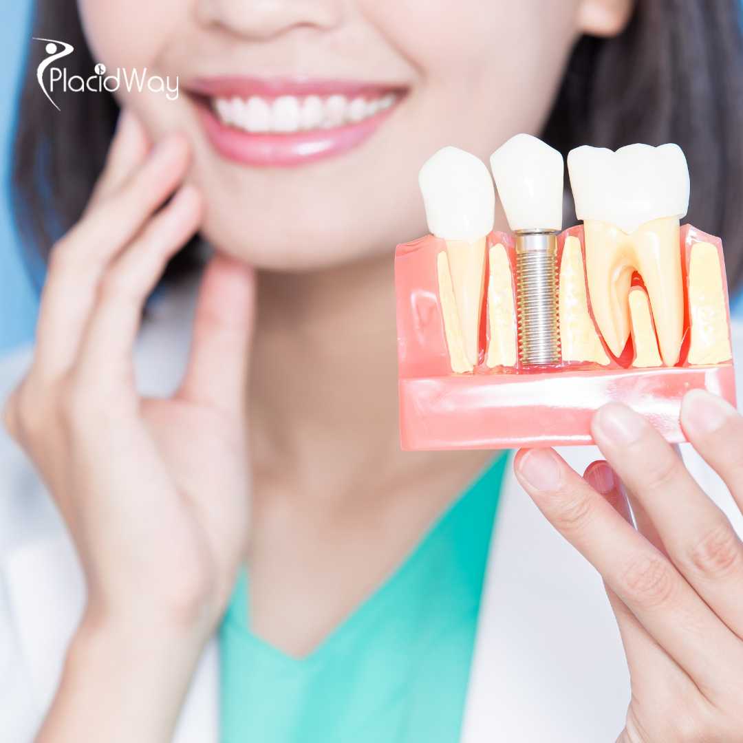 Dental Implants in Mexico