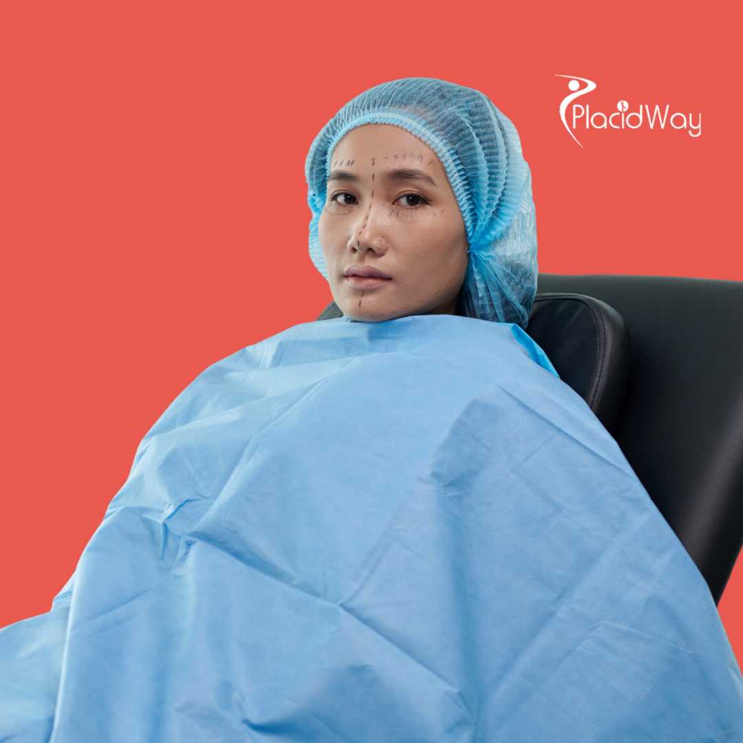 Deep Plane Facelift in South Korea