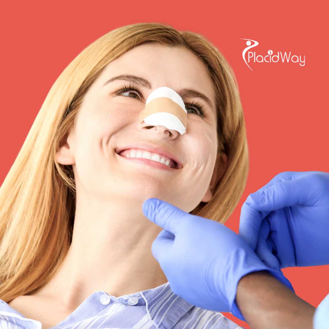 Rhinoplasty in Merida, Mexico