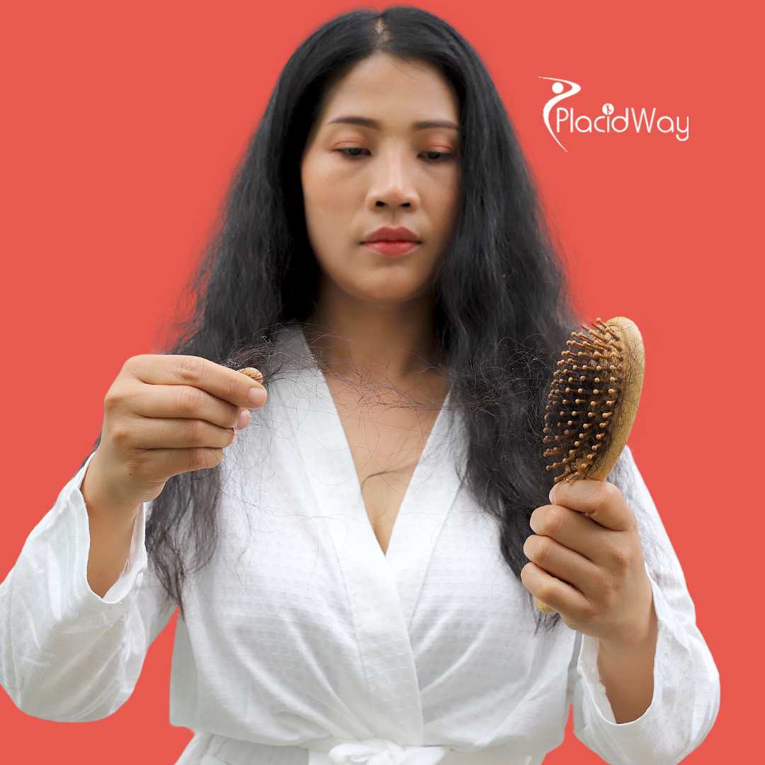 Stem Cell Therapy for Hair Loss in Japan