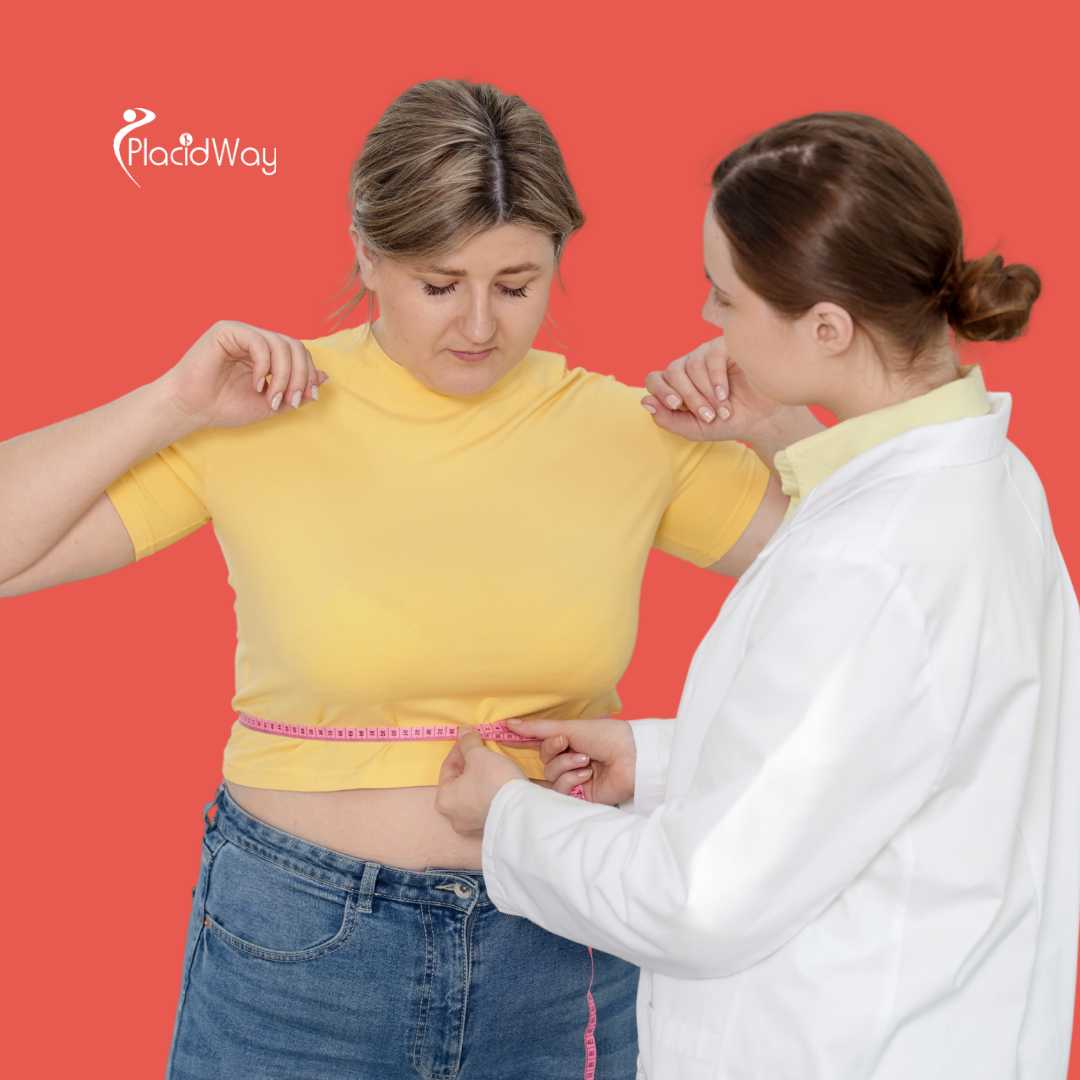 Bariatric Surgery in Mexicali Mexico