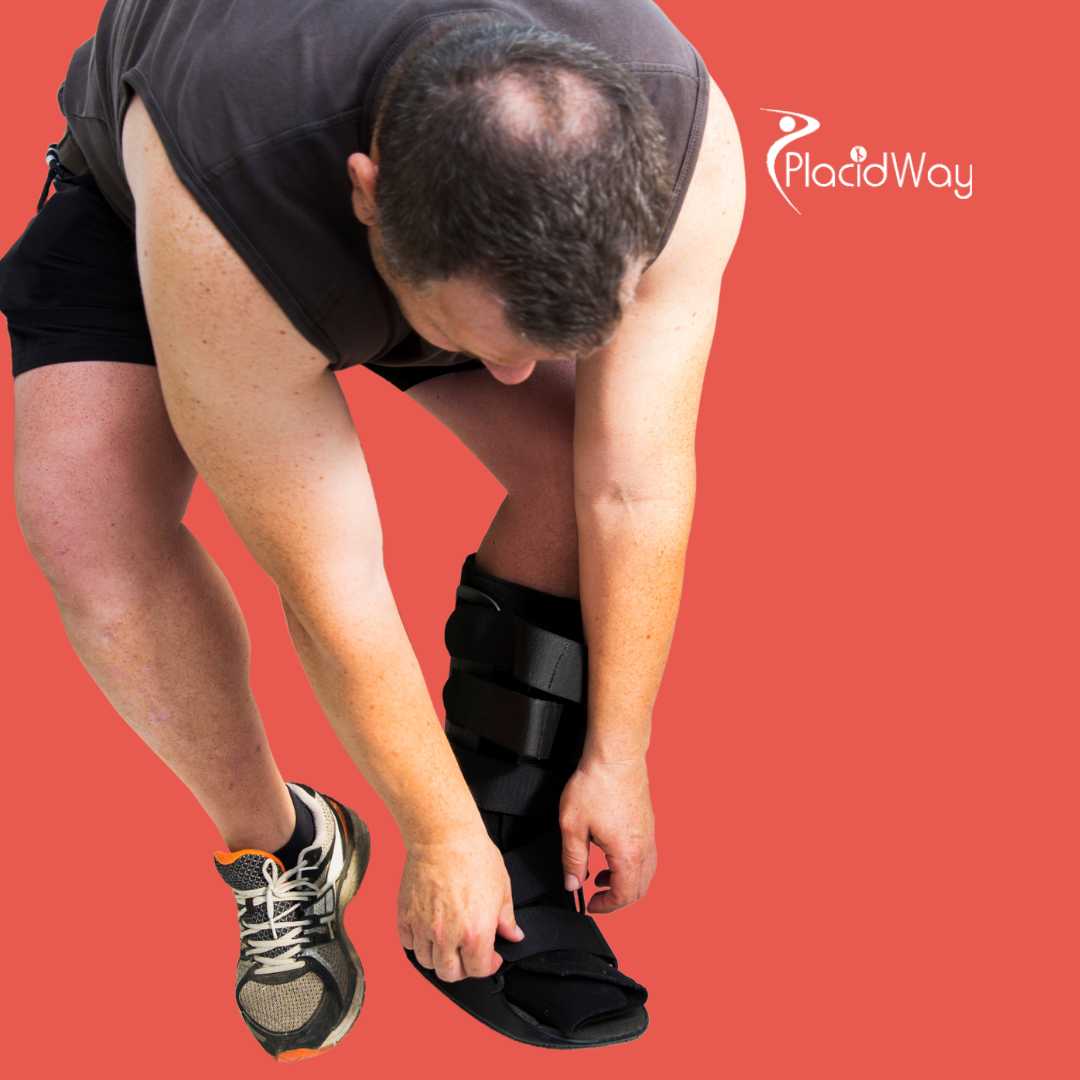 Stem Cell Therapy for Tendon Tears in Mexico