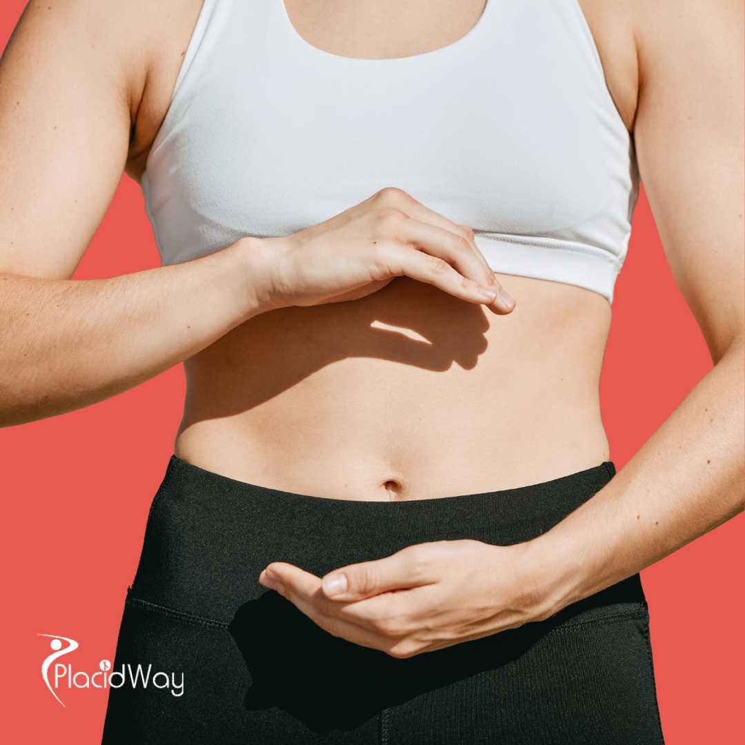 Tummy Tuck in Barranquilla, Colombia