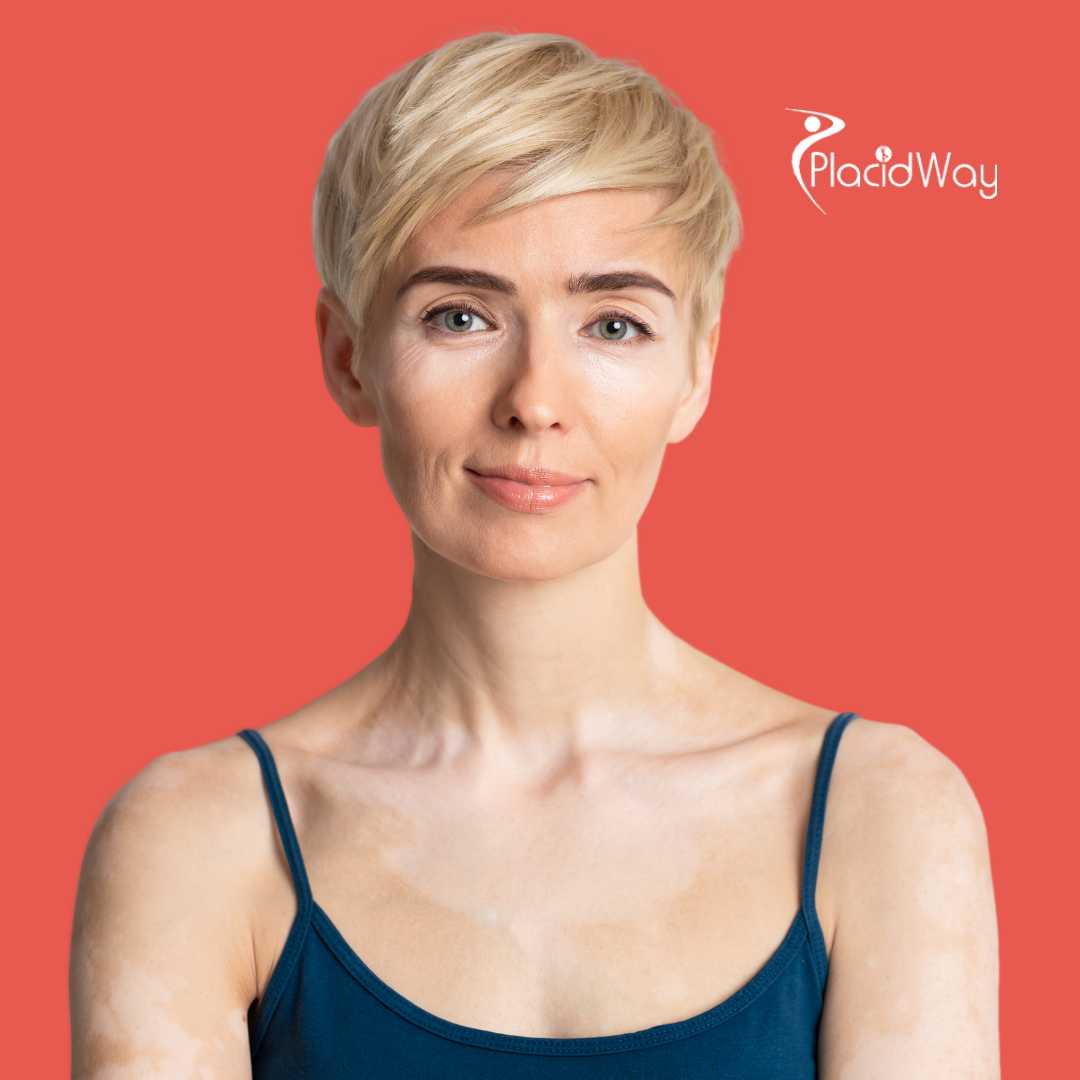 Stem Cell Therapy for Autoimmune Disease in Colombia