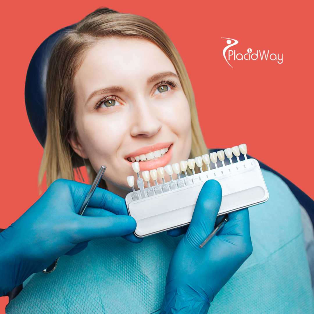 Dental Veneers in Zagreb Croatia