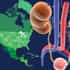Infographics-Top-Kidney-Failure-Treatments-in-Americas-Region