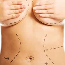 Great Savings Mommy Makeover Package in Tijuana, Mexico