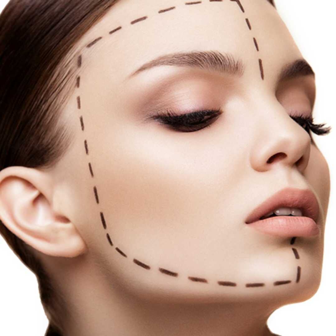 Gastelum Exclusive Facelift Surgery Package in Tijuana, Mexico