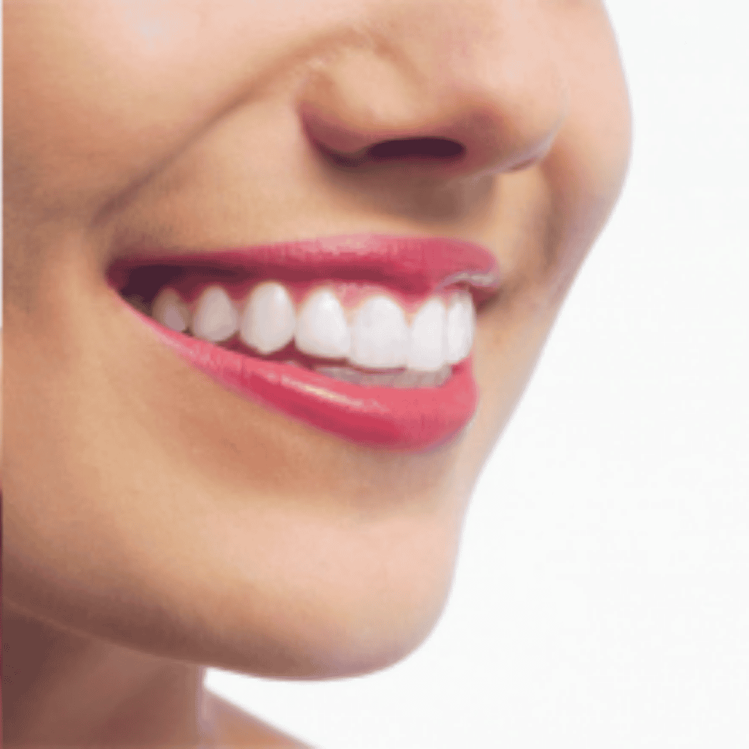 Smile Makeover Package by Bergedent Clinic in Istanbul, Turkey