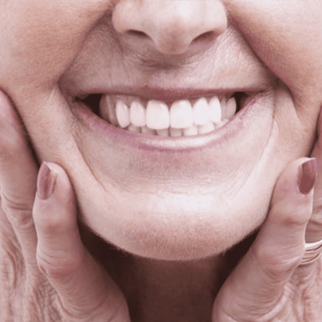 All on 4 Dental Implants in Costa Rica - Americas Dental Care