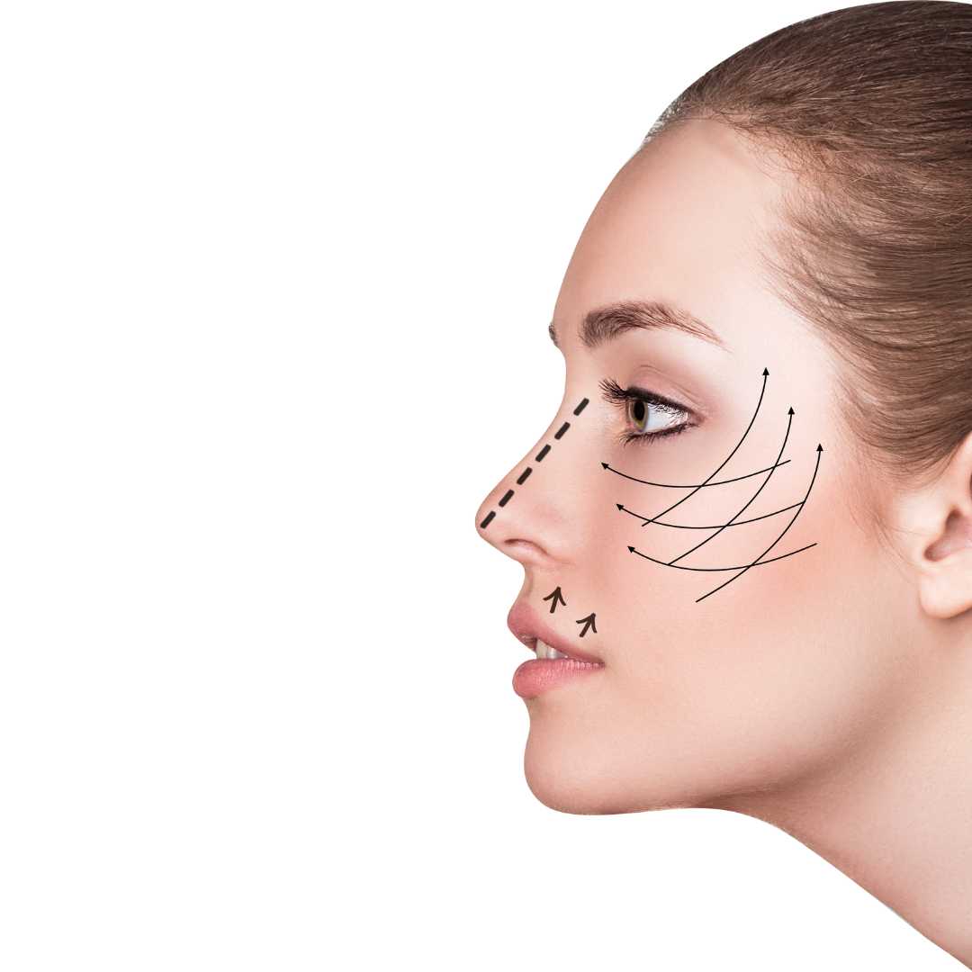 Face and Neck lift with Eyelids in Mexicali, Mexico