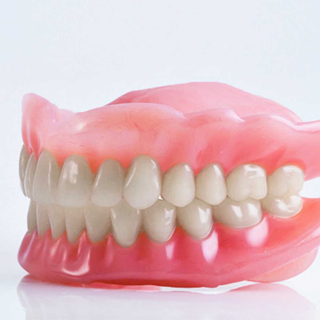 SANI Removable Partial Denture with Implant in Los Algodones