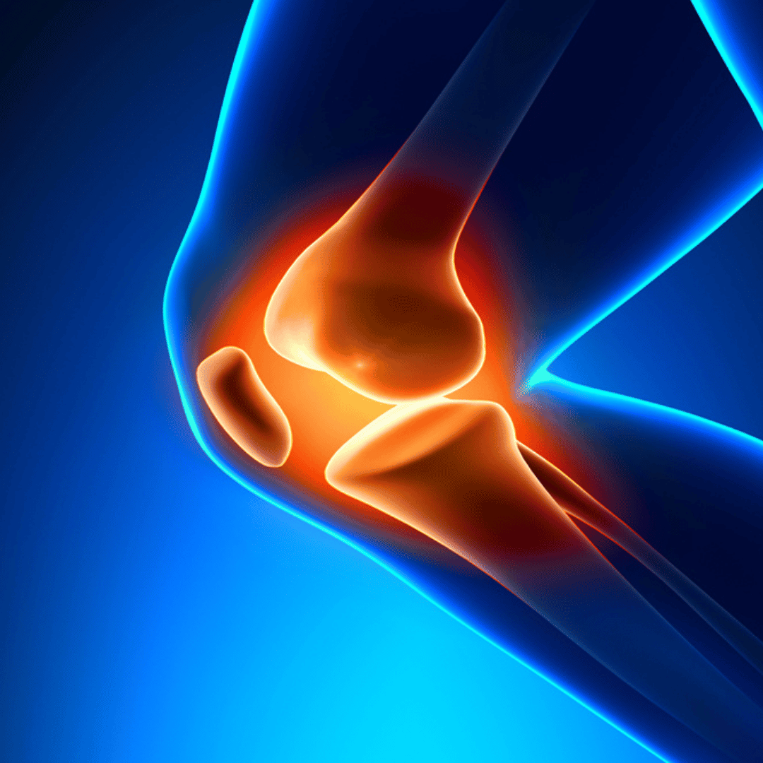Stem Cell Therapy for Joints in Mexico City Mexico at MexStemCells Clinic