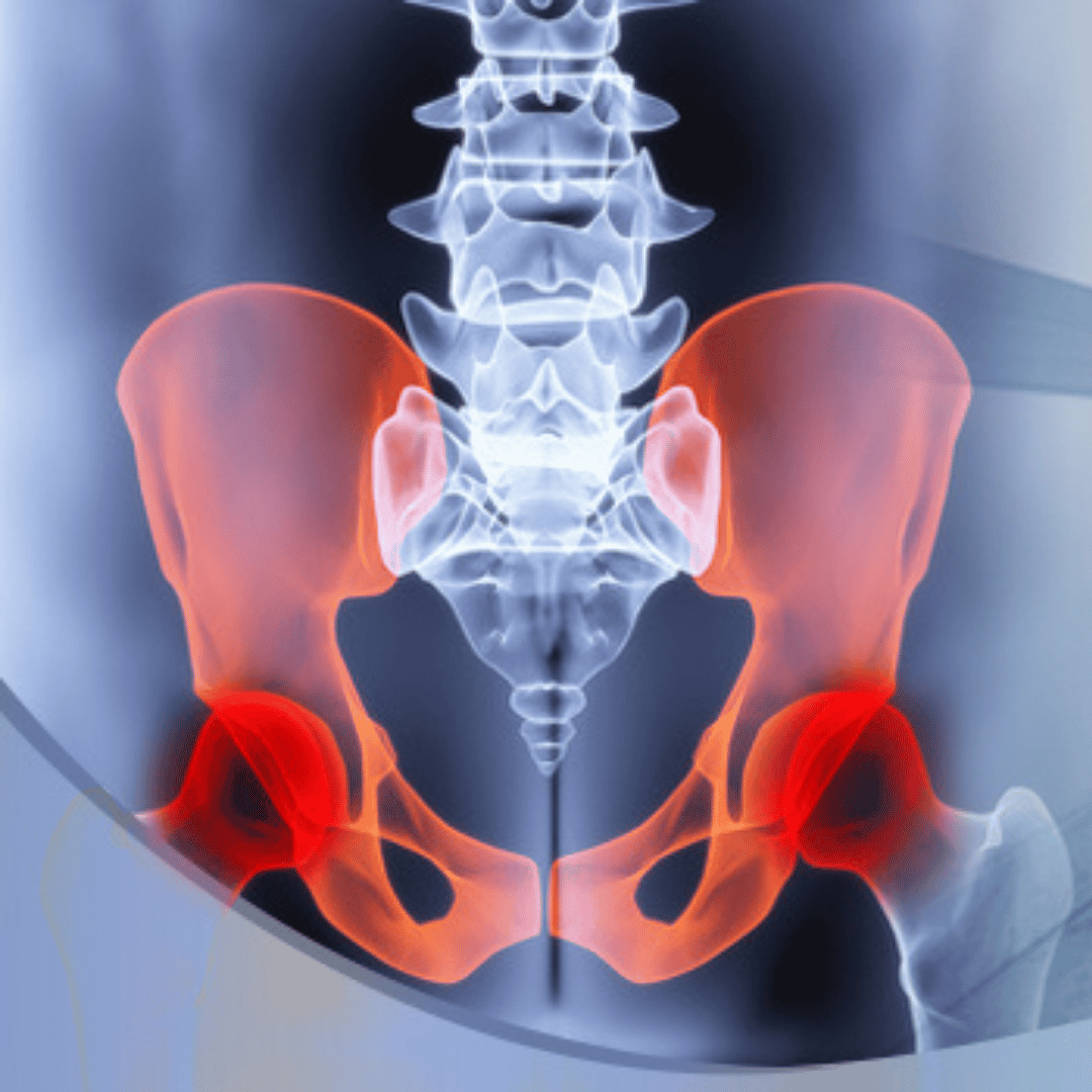 Top 10 Options for Successful Hip Replacement Surgery in Asia