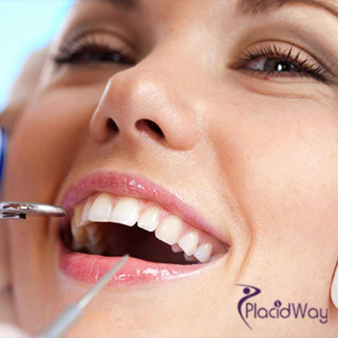 Affordable Package for Tooth Replacement in Costa Rica - $700
