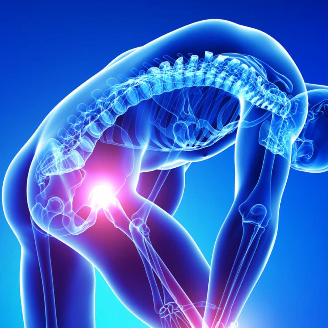 Hip Replacement Package in Delhi India
