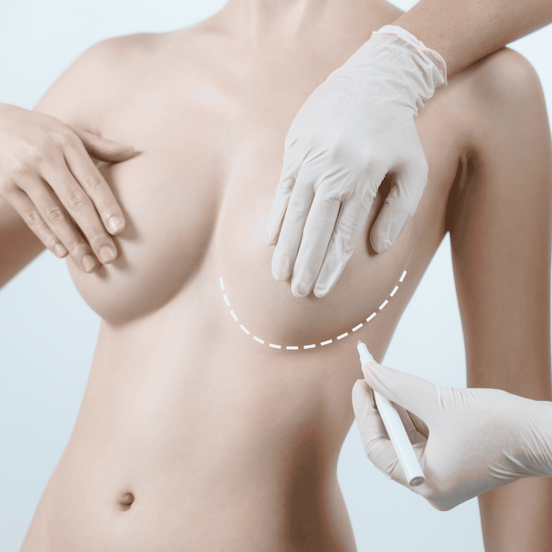 Most Affordable Breast Augmentation Package in San Jose, Costa Rica