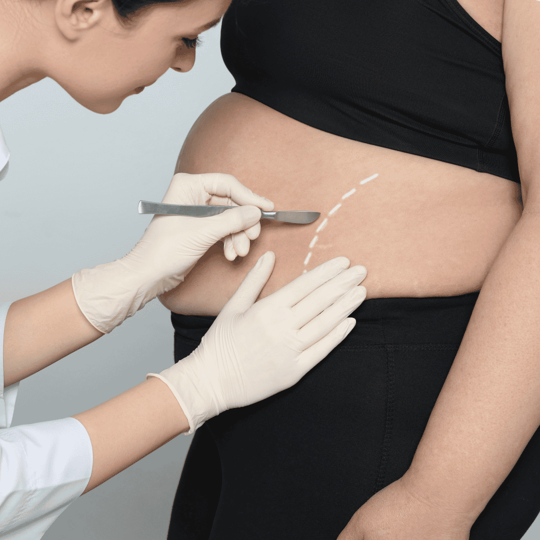 Exclusive Obesity Treatment Package in Mysore India
