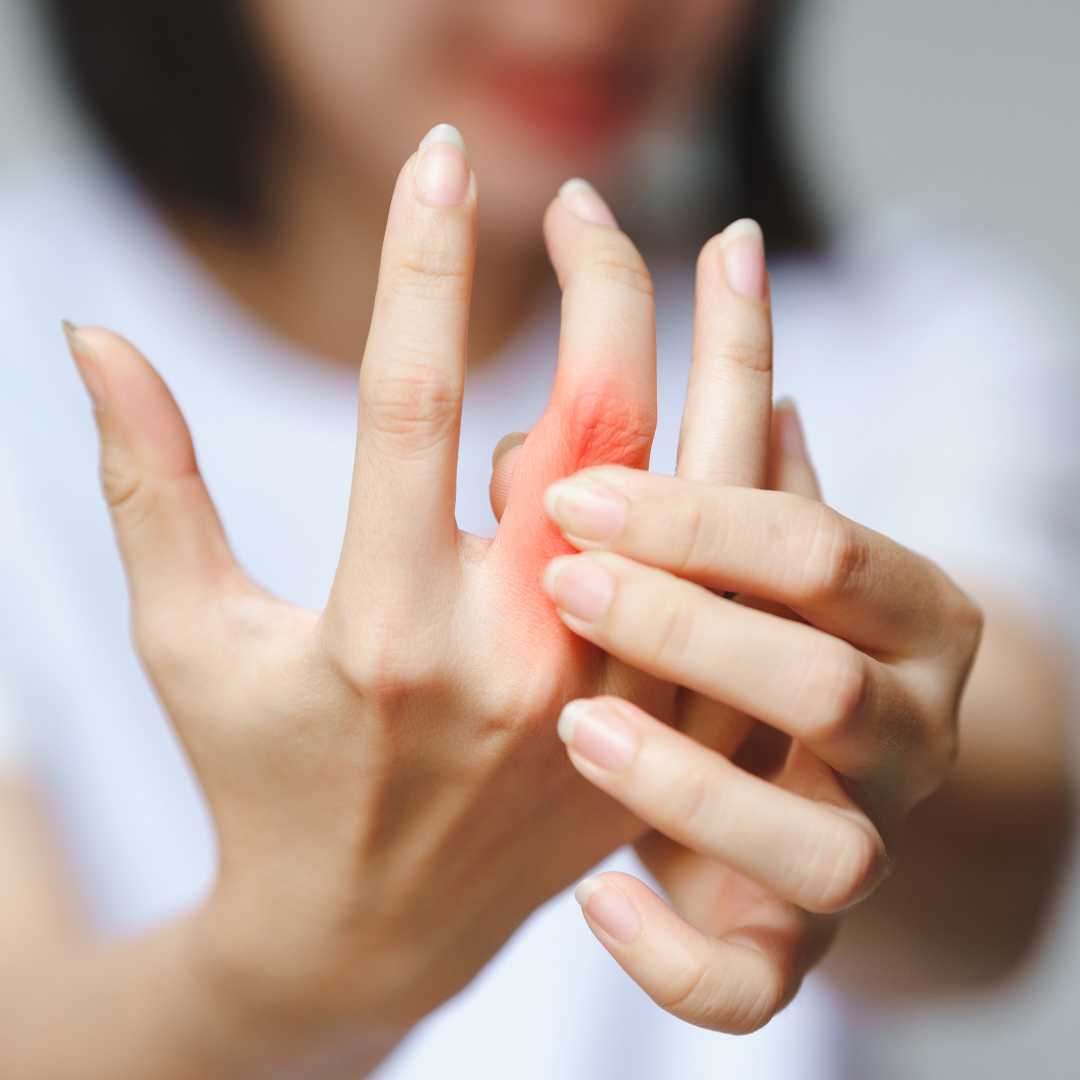 Stem Cell Therapy for Rheumatoid Arthritis Package in Mannheim, Germany by Dr. Gerald Zimmermann