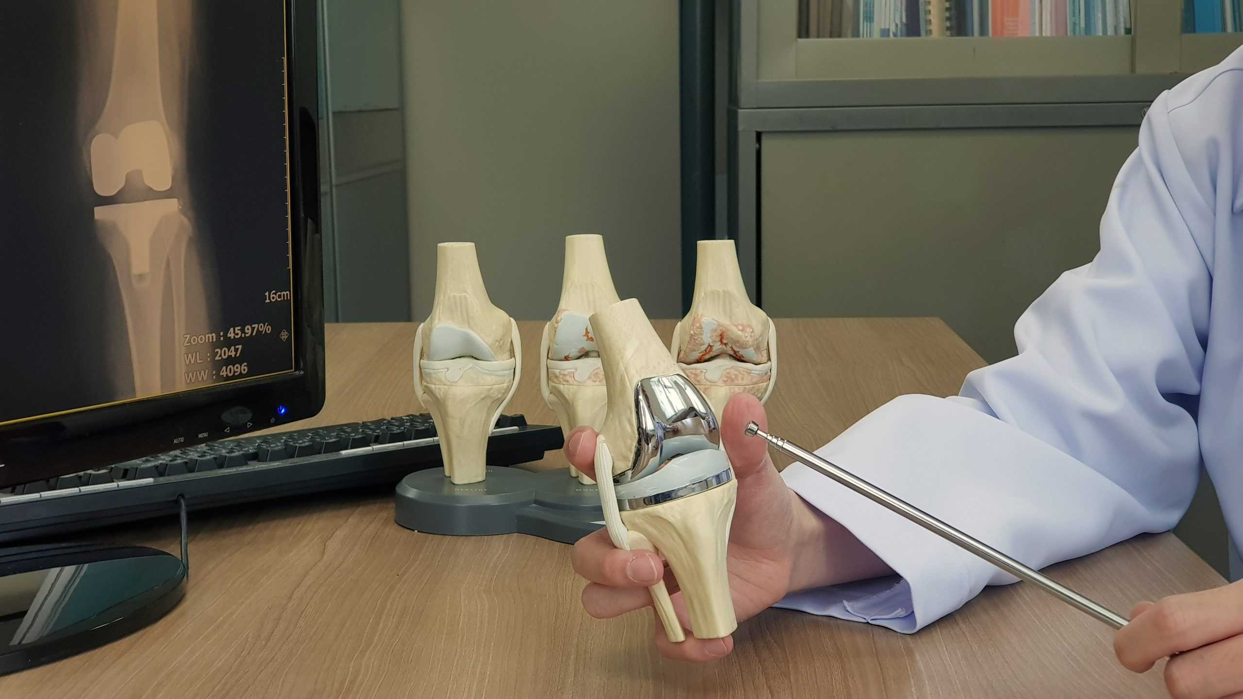  Total Knee Replacement (TKR) Treatment Package