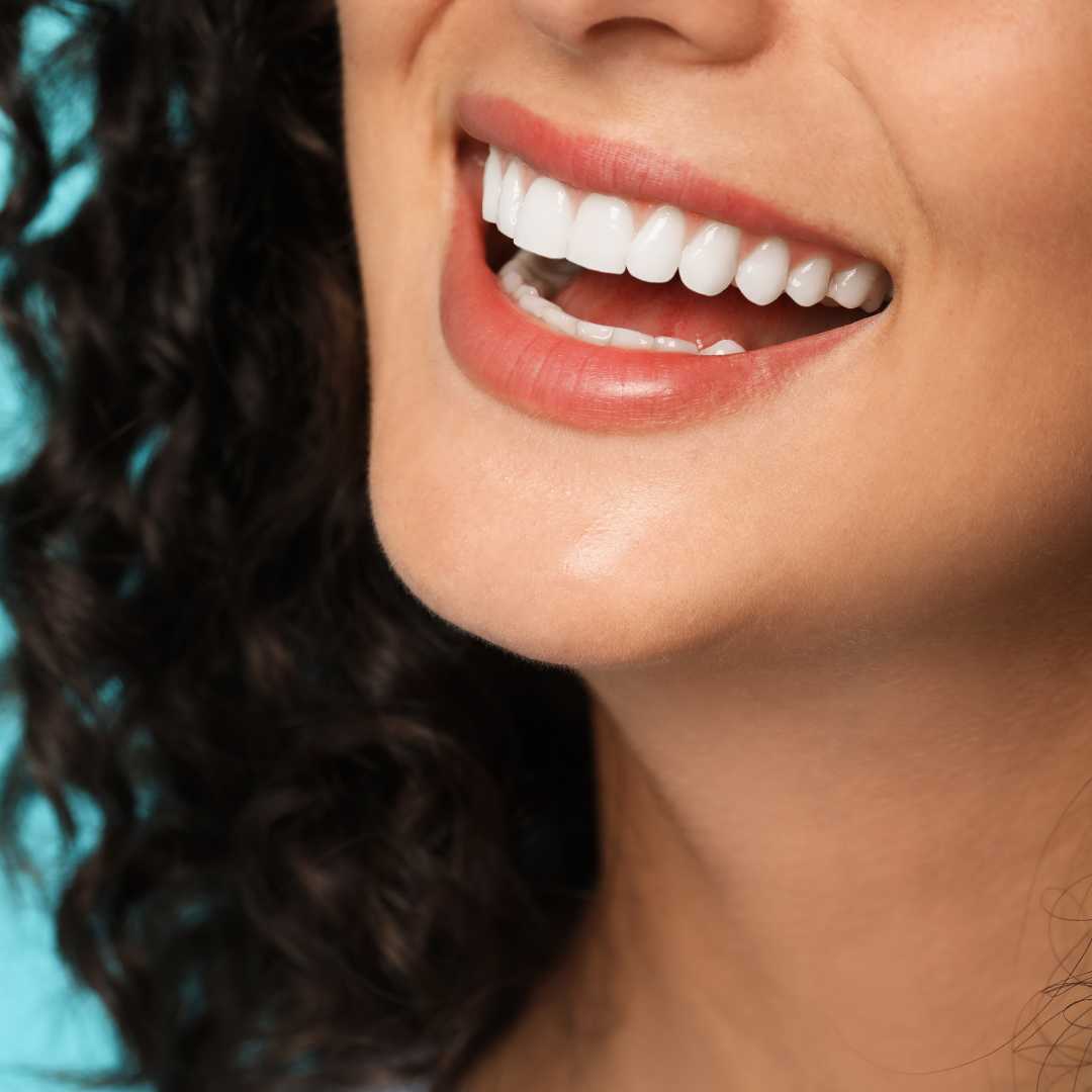 All on 4 Dental Implants Package at DentSpa, Şişli, Turkey