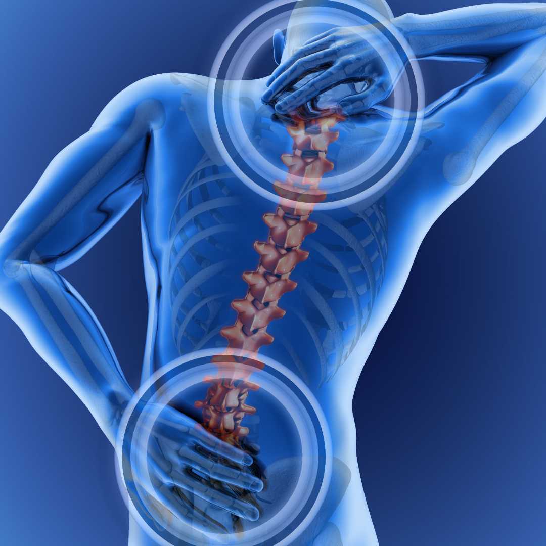 Cell Therapy for Neck & Back in Colombia — Packages Starting at $4,500
