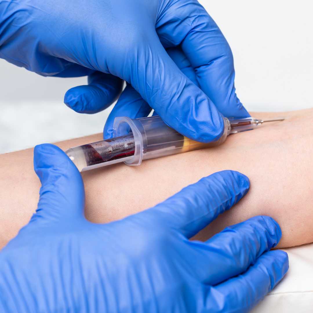 Blood Work Diagnostics Package at Rahib Medical Center, karachisd, Pakistan