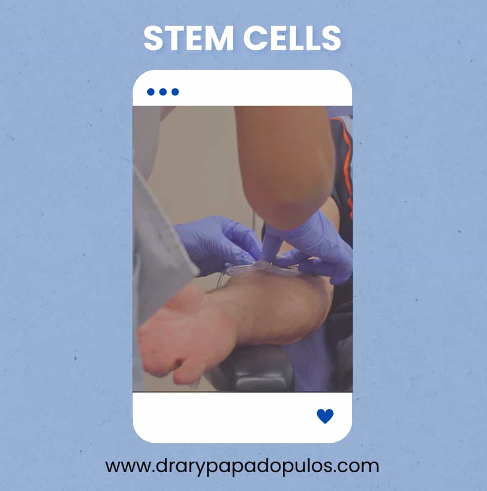 Stem Cell Treatments for Anti Aging Mexico Package by Dr. Papadopulos in Mexico City
